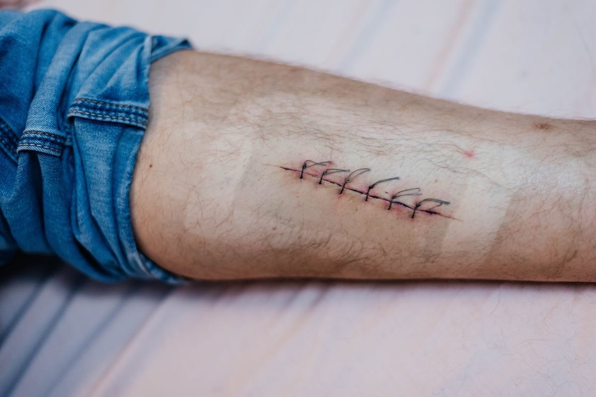 Cut Repair