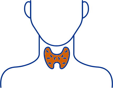 Thyroid Full Panel